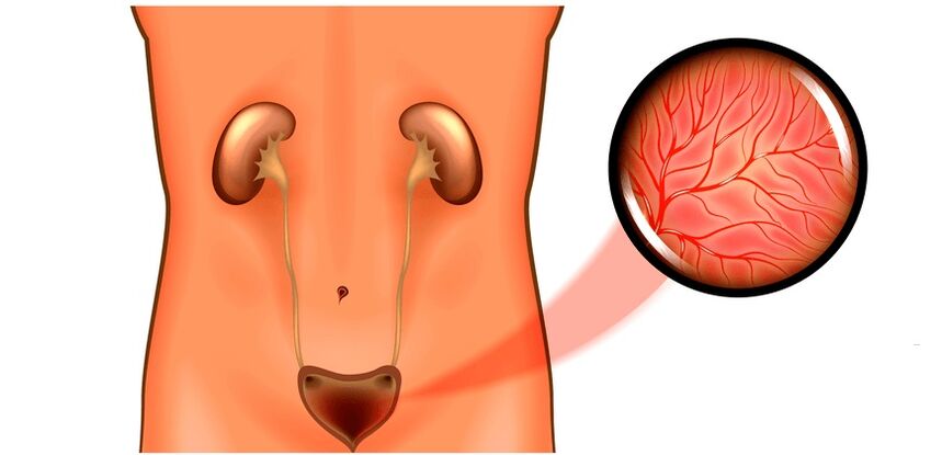 Clean in men symptoms and treatment